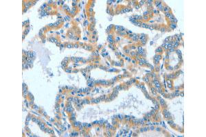 Immunohistochemistry (IHC) image for anti-Activating Signal Cointegrator 1 Complex Subunit 1 (ASCC1) antibody (ABIN2429539) (ASCC1 Antikörper)