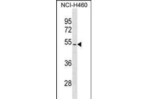 PTEN Antibody (/) (ABIN6242543 and ABIN6577361) western blot analysis in NCI- cell line lysates (35 μg/lane). (PTEN Antikörper  (AA 361-390))