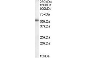 Western Blotting (WB) image for anti-Epithelial Splicing Regulatory Protein 2 (ESRP2) (N-Term) antibody (ABIN2156786) (ESRP2 Antikörper  (N-Term))