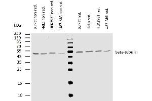 Western Blotting (WB) image for anti-Tubulin, beta (TUBB) antibody (ABIN93914)