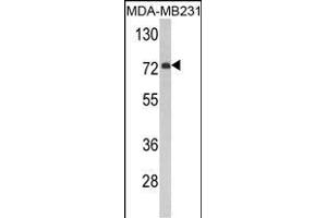 Western blot analysis of FMO3 Antibody (N-term) (ABIN390888 and ABIN2841098) in MDA-M cell line lysates (35 μg/lane). (FMO3 Antikörper  (N-Term))