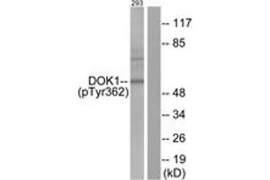 Western blot analysis of extracts from 293 cells, using p62 Dok (Phospho-Tyr362) Antibody. (DOK1 Antikörper  (pTyr362))