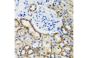 Immunohistochemistry of paraffin-embedded mouse kidney using COMT antibody. (COMT Antikörper)
