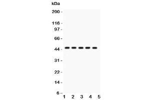 Western blot testing of PIM-1 antibody and human samples 1:  U20S (PIM1 Antikörper  (C-Term))