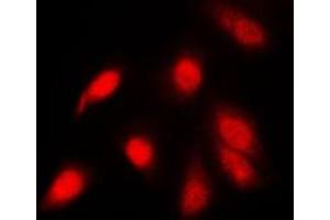 Immunofluorescent analysis of NF-kappaB p65 (pS311) staining in PC12 cells. (NF-kB p65 Antikörper  (pSer311))
