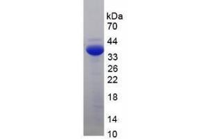 SDS-PAGE analysis of Human Adrenocorticotropic Hormone Protein. (POMC Protein)