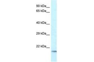 Image no. 1 for anti-Ubiquitin-Conjugating Enzyme E2 Variant 1 (UBE2V1) (C-Term) antibody (ABIN6747633) (UBE2V1 Antikörper  (C-Term))