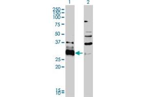 Western Blot analysis of HDGFRP3 expression in transfected 293T cell line by HDGFRP3 monoclonal antibody (M01), clone 2G12. (HDGFRP3 Antikörper  (AA 1-203))