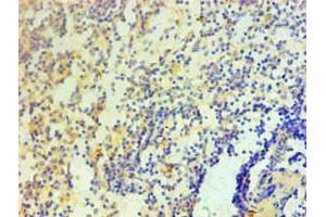 Immunohistochemical of paraffin-embedded Human spleen tissue using ABIN7156047 at dilution of 1:200. (IL1A Antikörper)