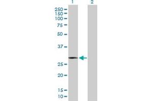 Western Blot analysis of HMOX1 expression in transfected 293T cell line by HMOX1 MaxPab polyclonal antibody. (HMOX1 Antikörper  (AA 1-288))