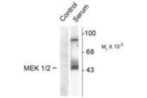 Image no. 2 for anti-Mitogen-Activated Protein Kinase Kinase 1 (MAP2K1) (pSer218), (Ser222) antibody (ABIN221121) (MEK1 Antikörper  (pSer218, Ser222))