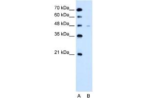 WB Suggested Anti-SLC43A3 Antibody Titration:  2. (SLC43A3 Antikörper  (N-Term))