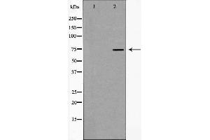Western blot analysis of hnRNP M expression in HT29 cells,The lane on the left is treated with the antigen-specific peptide. (HNRNPM Antikörper  (N-Term))