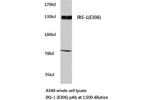 Western blot (WB) analyzes of IRS-1 antibody in extracts from A549 cells. (IRS1 Antikörper)