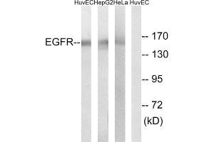 Western Blotting (WB) image for anti-Epidermal Growth Factor Receptor (EGFR) antibody (ABIN1848179) (EGFR Antikörper)