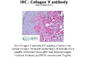 Image no. 1 for anti-Collagen, Type V (COL5) antibody (ABIN1733224) (Collagen Type V Antikörper)