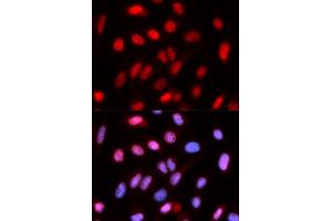 Immunofluorescence (IF) image for anti-Replication Factor C (Activator 1) 4, 37kDa (RFC4) antibody (ABIN1876673) (RFC4 Antikörper)