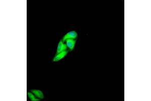 Immunofluorescence (IF) image for anti-Met Proto-Oncogene (MET) antibody (ABIN7127616)