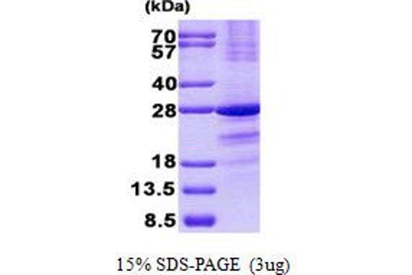 SSX1 Protein (His tag)