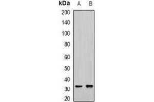 Western blot analysis of RCAS1 expression in mouse kidney (A), mouse liver (B) whole cell lysates. (RCAS1 Antikörper)