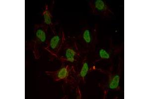 Immunofluorescence analysis of Hela cells using ESR1 mouse mAb (green). (Estrogen Receptor alpha Antikörper)