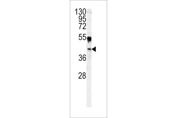 CA14 Antikörper  (N-Term)