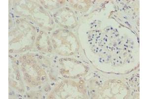 Immunohistochemistry of paraffin-embedded human kidney tissue using ABIN7151406 at dilution of 1:100 (EFCAB12 Antikörper  (AA 1-200))