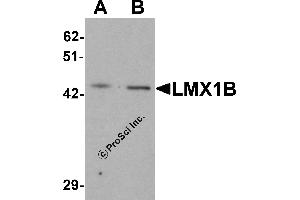 Western Blotting (WB) image for anti-LIM Homeobox Transcription Factor 1, beta (LMX1B) (C-Term) antibody (ABIN1077396) (LMX1B Antikörper  (C-Term))