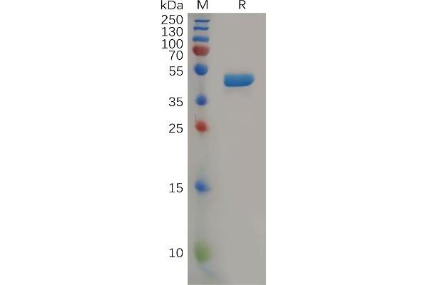 IL-2 Protein (AA 21-153) (mFc Tag)