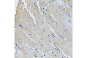 Immunohistochemistry of paraffin-embedded mouse heart using SRI antibody  at dilution of 1:100 (40x lens). (SRI Antikörper  (AA 1-198))