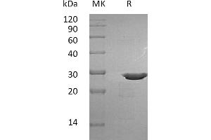 Greater than 95 % as determined by reducing SDS-PAGE. (Pro BDNF Protein)