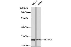 Western blot analysis of extracts of various cell lines, using TRADD antibody. (TRADD Antikörper)