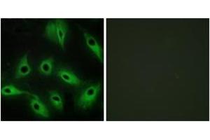 Immunofluorescence analysis of HeLa cells, using CDH9 Antibody. (Cadherin 9 Antikörper  (AA 201-250))