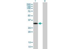 Western Blot analysis of ZBTB32 expression in transfected 293T cell line by ZBTB32 MaxPab polyclonal antibody. (ZBTB32 Antikörper  (AA 1-302))