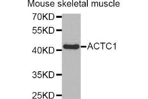 Western blot analysis of extracts of mouse skeletal muscle, using ACTC1 antibody (ABIN5973895). (ACTC1 Antikörper)