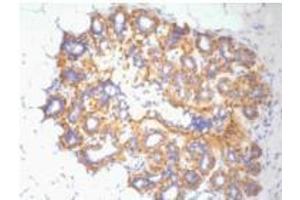 Immunohistochemistry (IHC) staining of Human ovary tissue, diluted at 1:200 (beta Actin Antikörper)