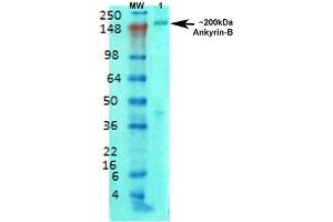 Nucleus. (ANK2 Antikörper  (AA 203-496) (FITC))