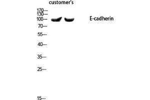 Western blot analysis of customer's using E-cadherin Polyclonal Antibody diluted at 1:1000. (E-cadherin Antikörper  (AA 1-80))