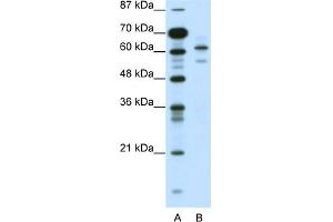 WB Suggested Anti-ZSCAN2 Antibody Titration:  0. (ZSCAN2 Antikörper  (N-Term))