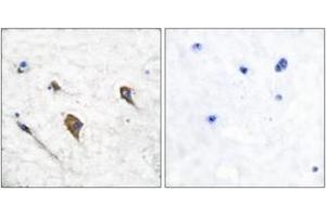 Immunohistochemistry analysis of paraffin-embedded human brain, using IL-3R beta (Phospho-Tyr593) Antibody. (CSF2RB2 Antikörper  (pTyr593))