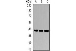 Western blot analysis of CDK6 expression in SW620 (A), Hela (B), Jurkat (C) whole cell lysates. (CDK6 Antikörper)