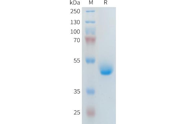 PLA2R1 Protein (AA 21-164) (Fc Tag)