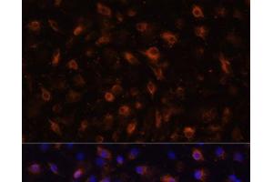 Immunofluorescence analysis of RAW264. (TLR4 Antikörper)