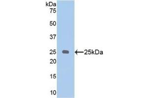 Detection of Recombinant PSA, Human using Polyclonal Antibody to Puromycin Sensitive Aminopeptidase (PSA) (NPEPPS Antikörper  (AA 584-793))