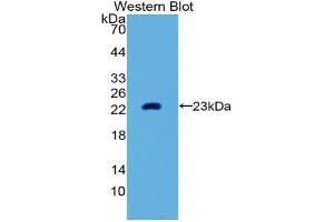 Detection of Recombinant MMP3, Human using Polyclonal Antibody to Matrix Metalloproteinase 3 (MMP3) (MMP3 Antikörper  (AA 289-452))