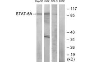 Western blot analysis of extracts from HepG2/K562/COLO cells, using STAT5A (Ab-694) Antibody. (STAT5A Antikörper  (AA 666-715))
