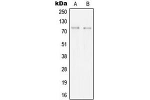 Western blot analysis of SYK expression in BJAB (A), Ramos (B) whole cell lysates. (SYK Antikörper  (Center))