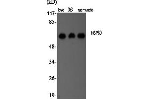 Western Blotting (WB) image for anti-Heat Shock 60kDa Protein 1 (Chaperonin) (HSPD1) antibody (ABIN5956900) (HSPD1 Antikörper)