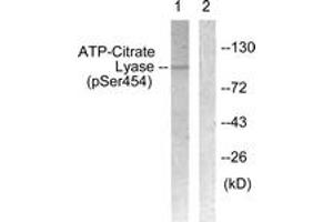 Western blot analysis of extracts from COS7 cells treated with Calyculin 50nM 30', using ATP-Citrate Lyase (Phospho-Ser454) Antibody. (ACLY Antikörper  (pSer455))