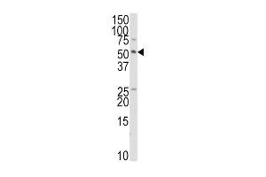 Western blot analysis of anti-TRAIP Antibody in HepG2 cell line lysates (35ug/lane). (TRAIP Antikörper  (C-Term))